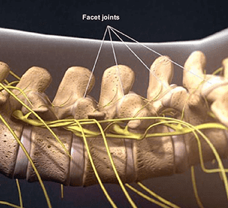 Facet joint injection - Knoxville, TN