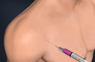 Injection for shoulder pain - Knoxville, TN