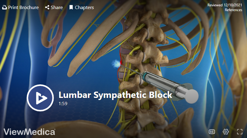 Lumbar Sympathetic Block in Knoxville - Omega Pain Management