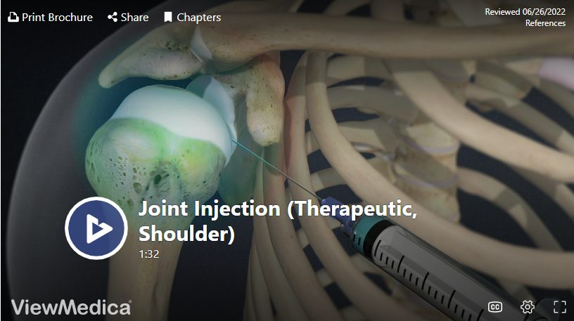 Shoulder Injection In Knoxville TN Omega Pain Management   Shoulder Injection 